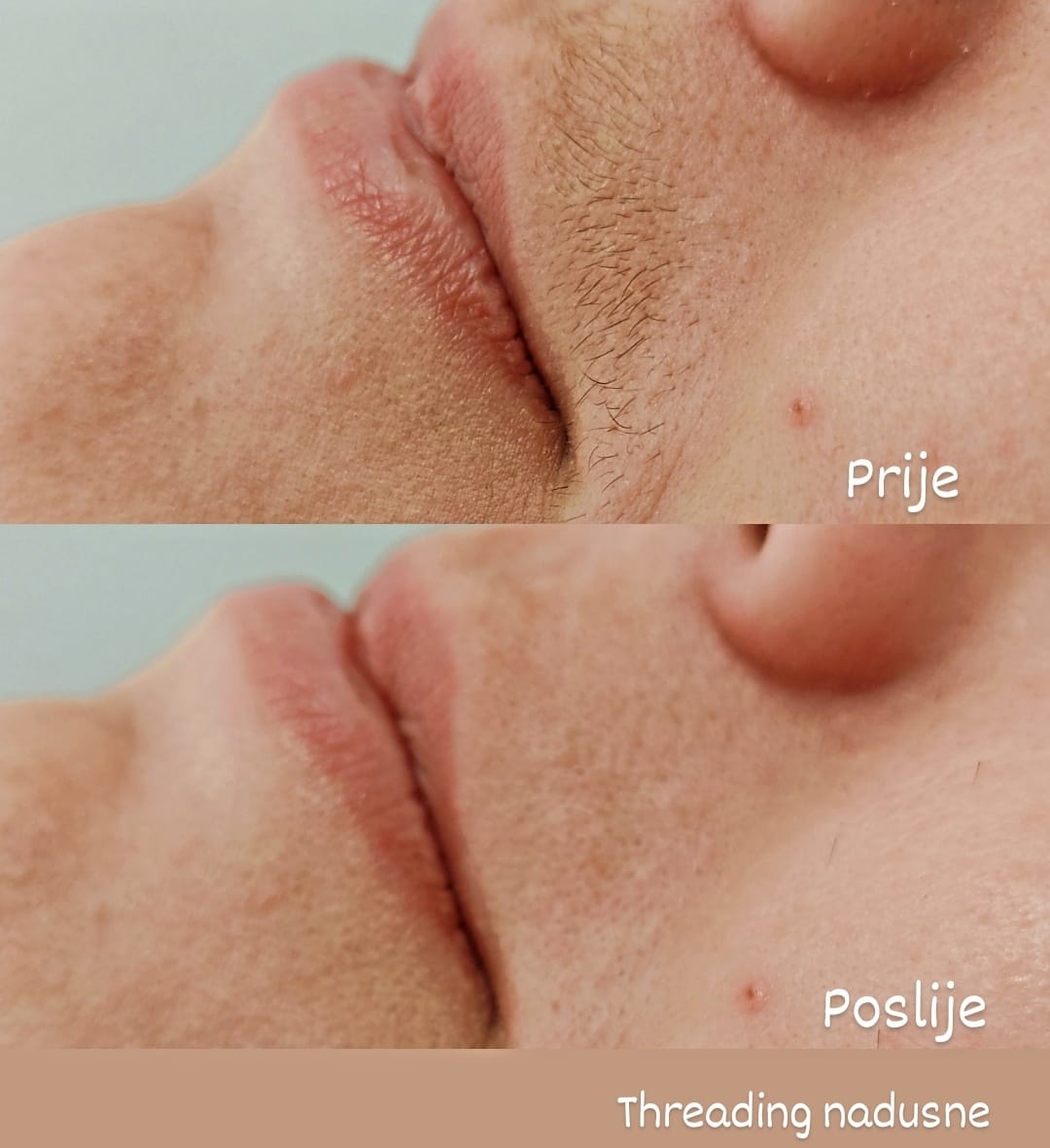 Threading nadusne — prije i poslije
